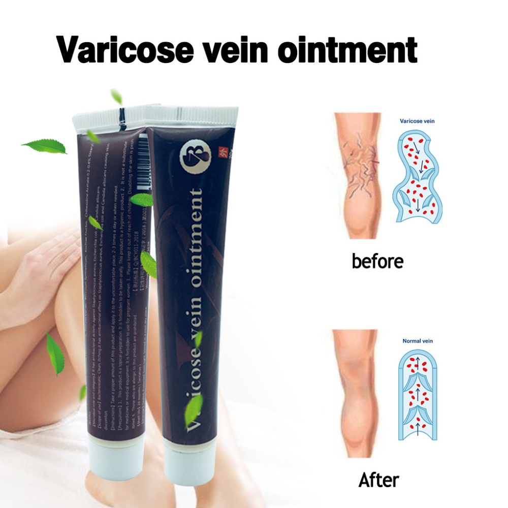 Varicose Ointment Body Care for Veins Flat Soft - Image 3