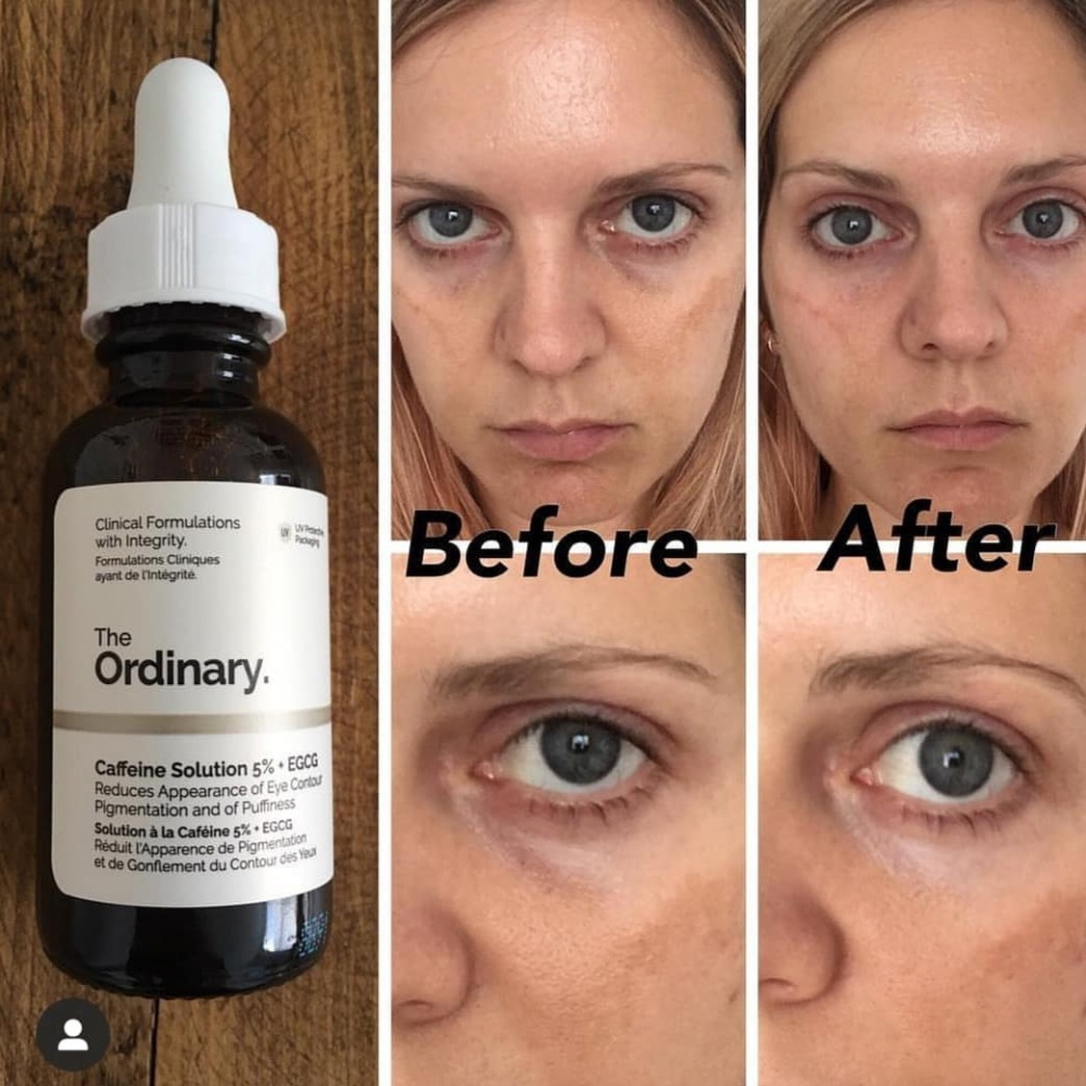 The Ordinary Caffeine Solution 5% + EGCG yellow_30ml - Image 2