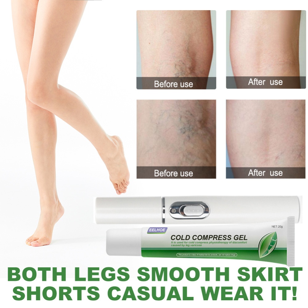 Varicose Vein Cold Compress Gel Leg Joint Care Pain Swelling Relief Body Cream Suit_20g - Image 3