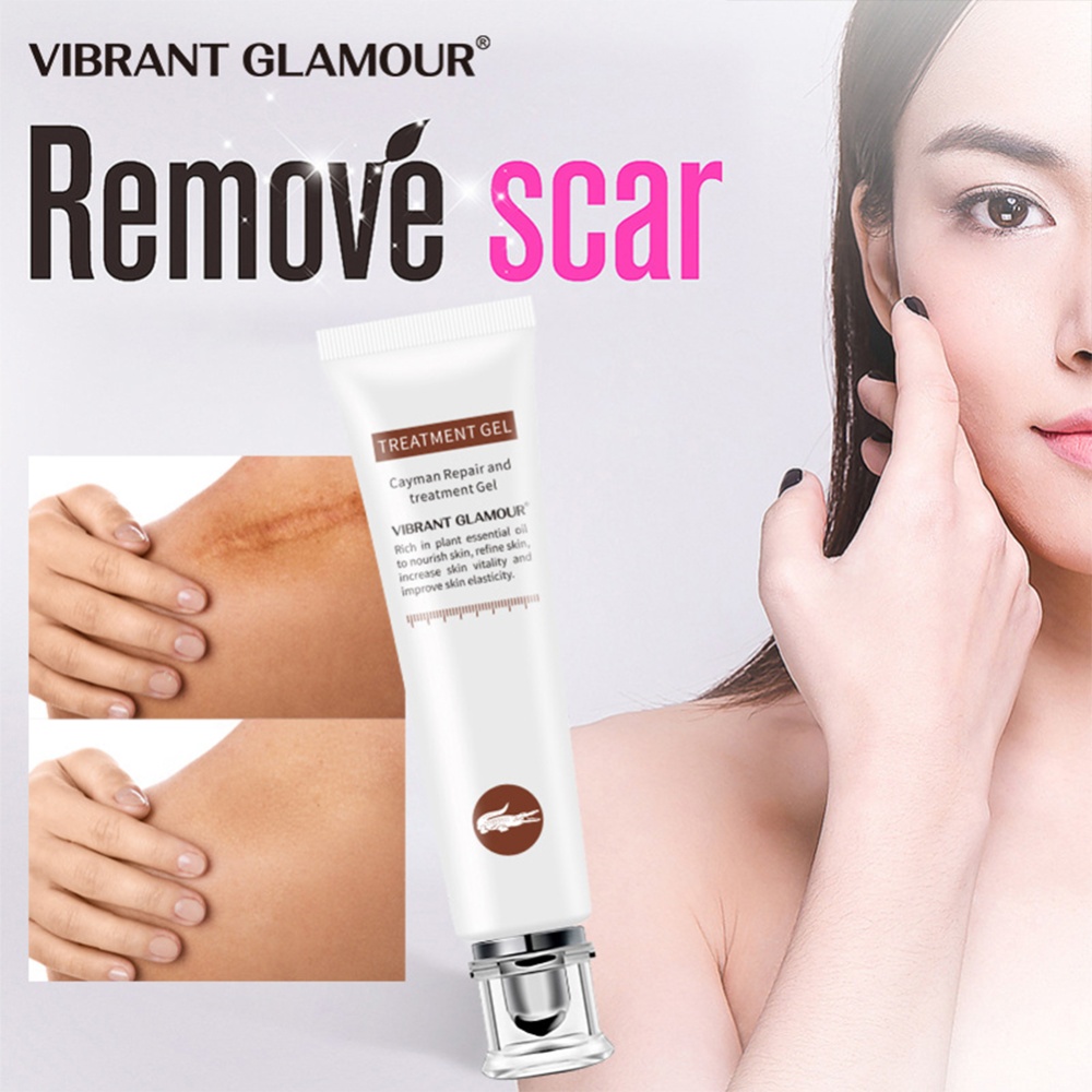 Repair Gel Scars Acne Stretch Marks Remove Whitening Cream Skin Care 20g - Image 2